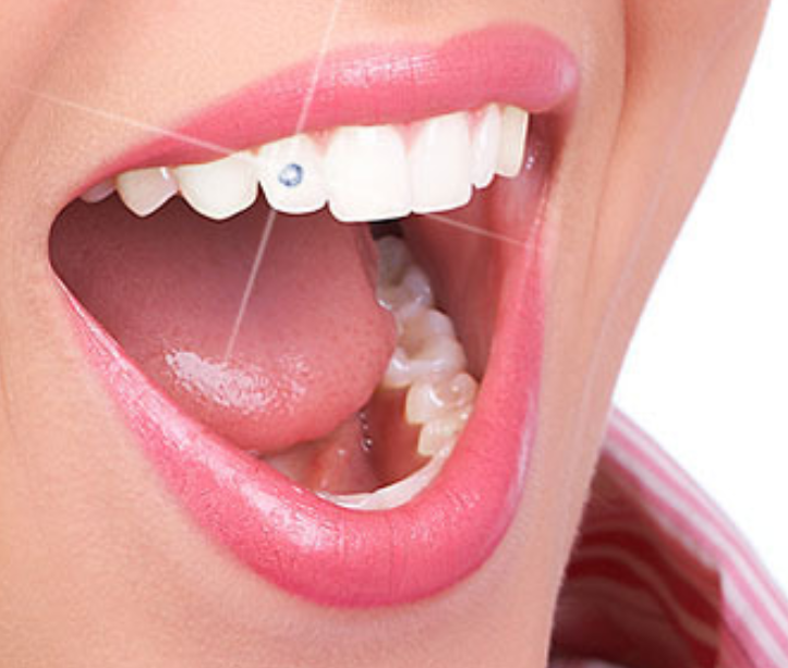 Swarovski Tooth Gem - Image 3